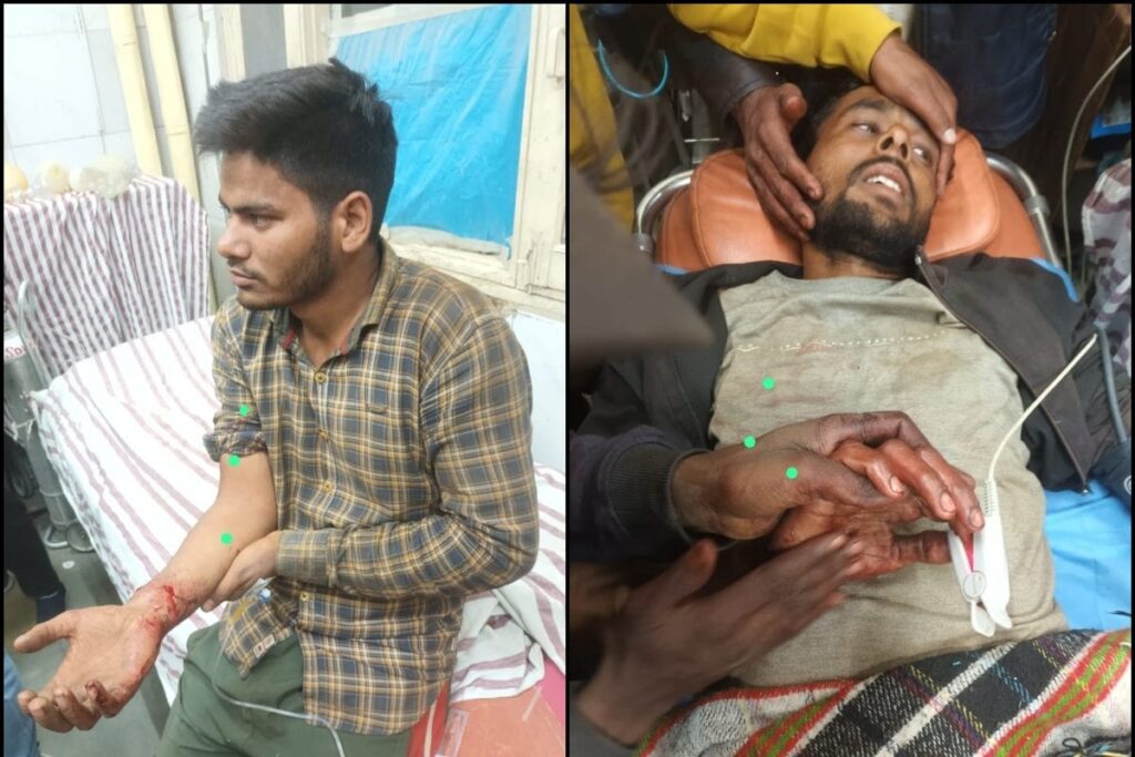 Two Non-Locals Shot At in J&K's Budgam, Admitted To Hospital