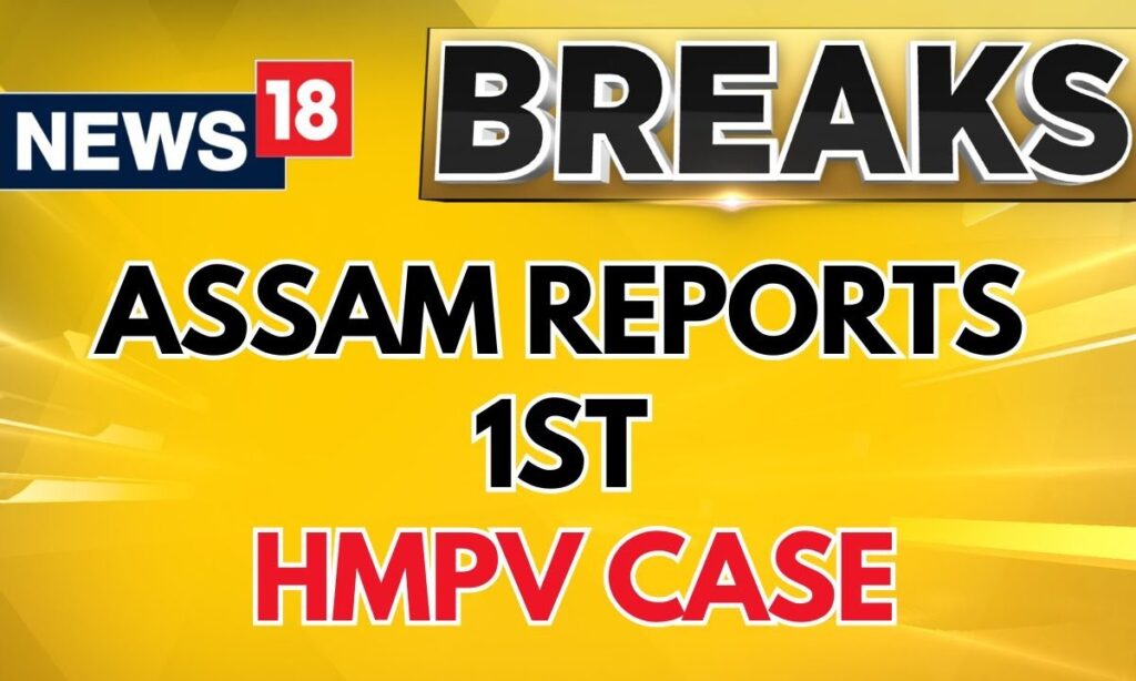 Breaking News: Another HMPV Case Detected in 10-Month-Old Child from Assam | HMPV Virus in India