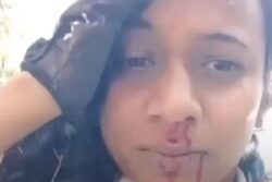 Caught On Camera: Maharashtra Biker Girl Physically Assaulted On Road By Couple