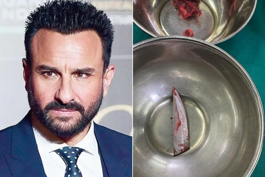 Picture Of Knife Lodged In Saif Ali Khan's Spine: 'A Real Hero, Walked In Hospital Like Lion'