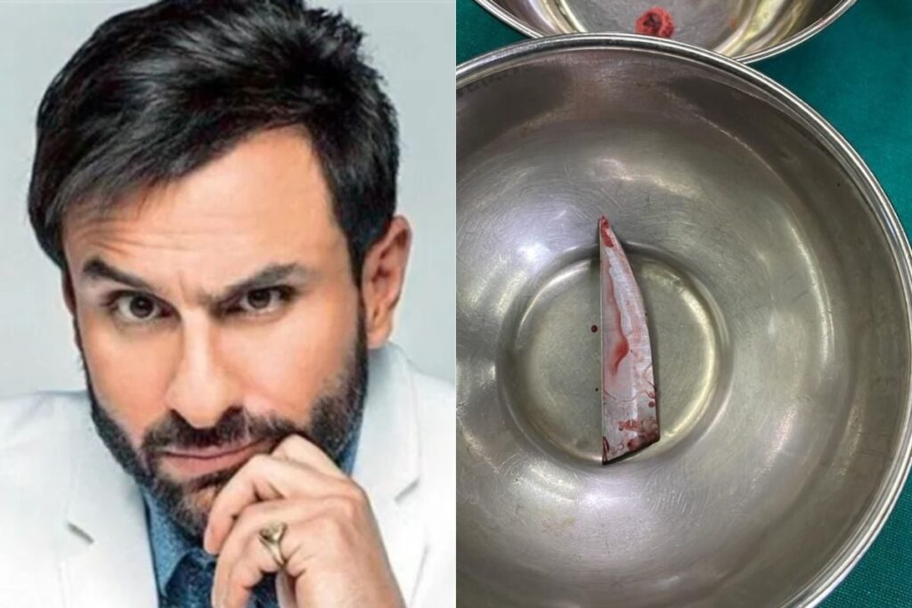 Doctors Say Saif Ali Khan Escaped Serious Spine Injury: 'If Knife Was 2 mm Deeper...'