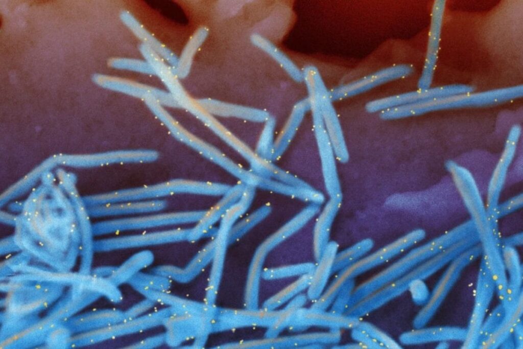 Maharashtra's GBS Tally Rises To 207 After 2 New Cases; Kolhapur Woman's Death Suspected From Ailment