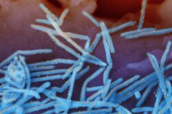 Maharashtra's GBS Tally Rises To 207 After 2 New Cases; Kolhapur Woman's Death Suspected From Ailment