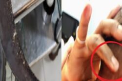 Toddler Survives Sickle Piercing Neck in Pune; Timely Surgery Saves Life