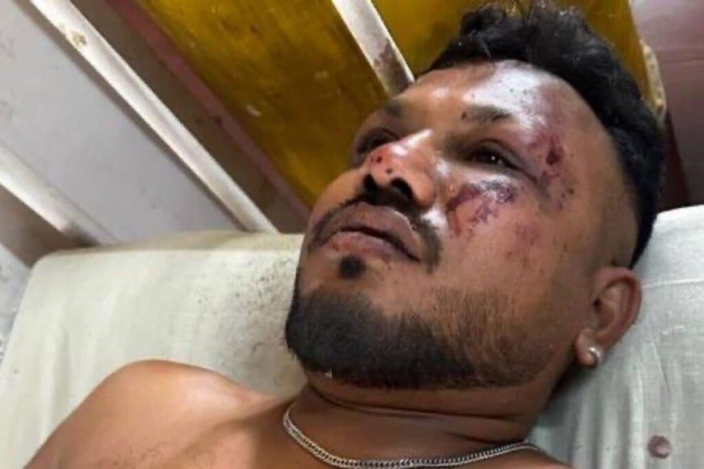 'I Still Can't Believe I Made It Out Alive': Lone Survivor of Ahmedabad Plane Crash Describes Narrow Escape