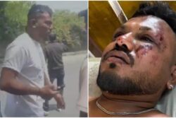 Lone Survivor Of Ahmedabad Plane Crash Discharged From Civil Hospital
