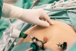 Surgical Cloth Found In Ghaziabad Woman's Stomach Days After C-Section