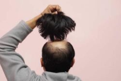 Angered By ‘Jija Ji’ Screaming At Sister, UP Man ‘Pulls Out’ Patch Of His Hair