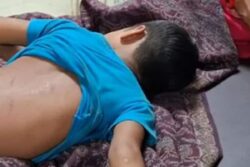 Bihar School Principal’s Nephew Beats 5-Year-Old With Belt, Pricks Her With Needles