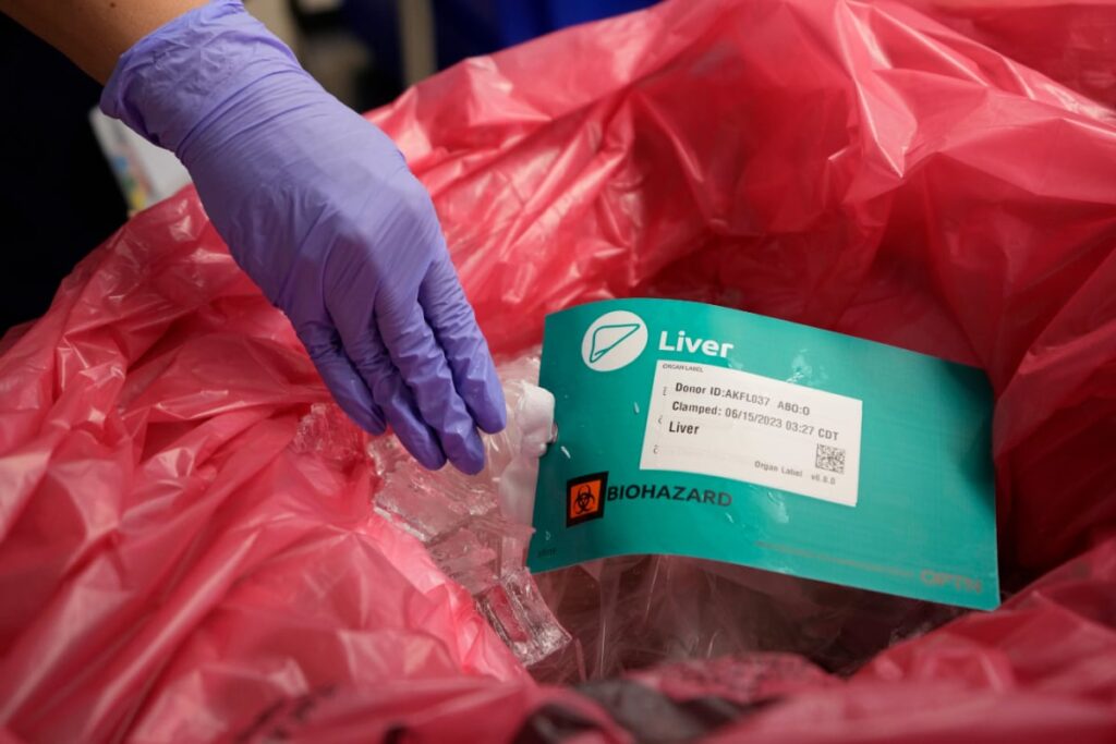 'One Donor Can Save Eight Lives': Centre Urges Ministries To Promote Organ Donation