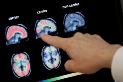 Kerala On Alert As Deadly 'Brain-Eating Amoeba' Claims 19 Lives