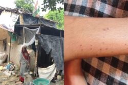 'After My Life': Teenager From UP Village Says 'Same Black Snake' Bit Her '13 Times In 40 Days'