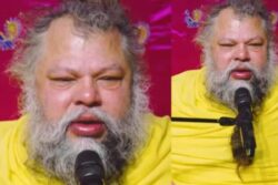 Premanand Maharaj's Health Worries Devotees As Video Shows Him With Swollen Eyes, Red Face