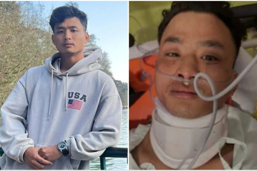 'We Stand With You': Uttarakhand CM Speaks To Father Of Tripura Student Killed In Racial Attack