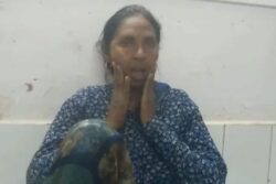 UP Woman’s Mouth Stuck Open After Jaw Dislocates While Eating Golgappa