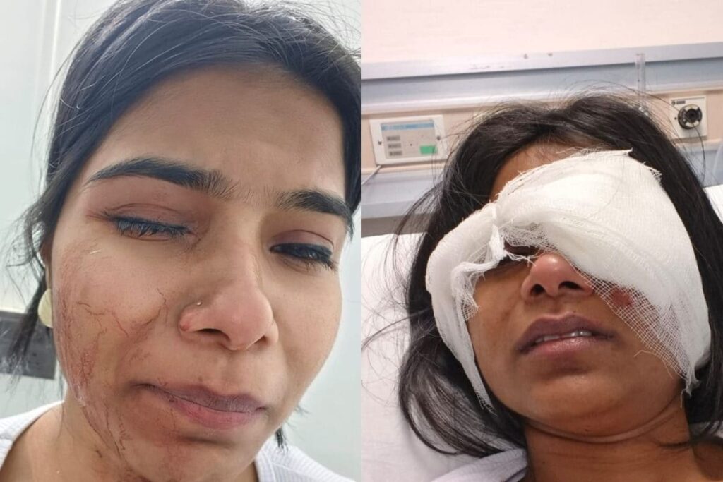 Pune Road Rage: Woman Suffers Serious Eye Injury After Bike-Borne Men Chase Car, Smash Windows