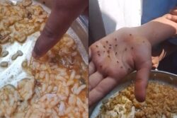 Worms Found In Midday Meal At Karnataka Govt School, Parents Demand Action