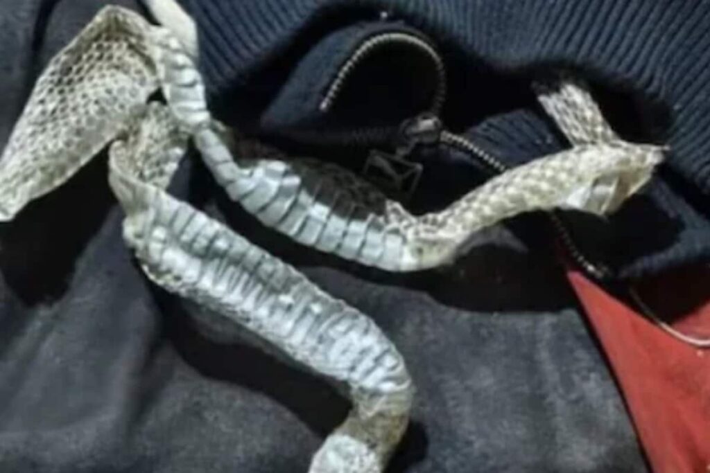 UP Woman Disappears Overnight, 'Snake Skin' Found On Her Bed In Morning
