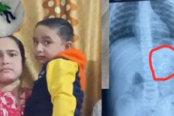 Ahmedabad Toddler Swallows 'The Hulk’, Shocking X-Ray Leaves Doctors Stunned