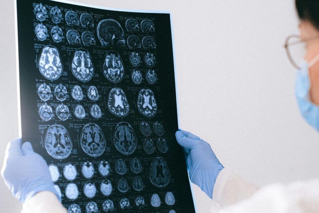 Mid-Life, Menopause May Be A Key Window For Alzheimer's Risk In Women, New Study Finds