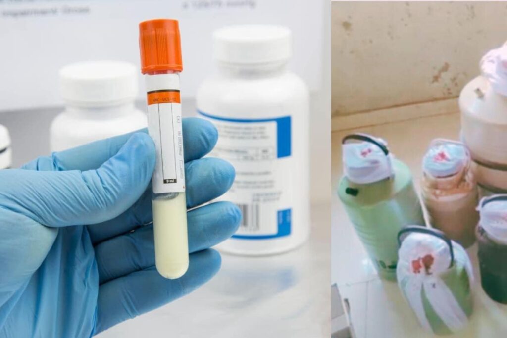 Sperm Smuggling Racket Busted Near Mumbai, Samples Were Being Sold To Doctors For Profit