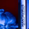 India Has Seen Cases Of Hantavirus In The Past, It Gave Only Mild Kidney Symptoms: Top Epidemiologist