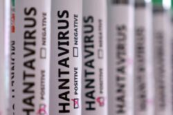 Two Indians Under Watch As Hantavirus Outbreak Confirmed On Cruise Ship; Ministry On Alert